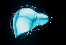 Jangan Anggap Sepele! 12 Gejala Liver Parah Ini Bisa Berujung Transplantasi Hati