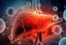 Waspada! Hepatitis Bisa Menyerang Tanpa Gejala, Ini Cara Mencegahnya Sebelum Terlambat