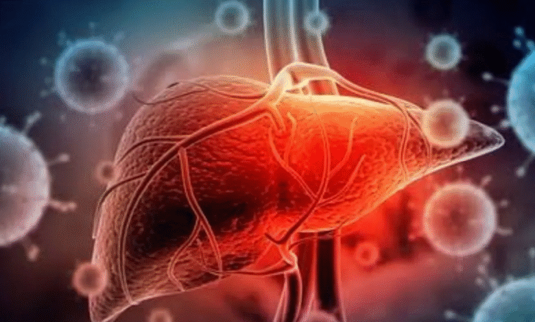 Waspada! Hepatitis Bisa Menyerang Tanpa Gejala, Ini Cara Mencegahnya Sebelum Terlambat