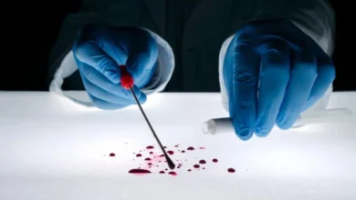 Polisi Autopsi Jenazah Rizky Ramadhan, Usut Tuntas Kematian Misterius Bocah 3 Tahun