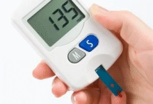 Jangan Remehkan Luka Tak Sembuh di Kaki! Bisa Jadi Tanda Diabetes Parah dan Berujung Amputasi