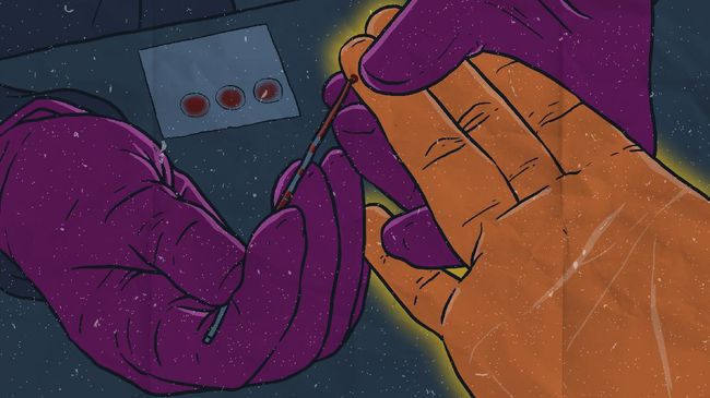 Waspada! Studi Terbaru Ungkap Golongan Darah Ini Lebih Rentan Kena Stroke di Usia Muda