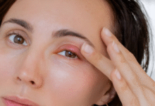 Mata Bintitan Bikin Tak Nyaman? 3 Cara Cepat dan Aman Mengatasi Sendiri di Rumah