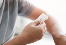 Ini 3 Prinsip Dasar Merawat Luka Ringan: Clean, Cover, and Care