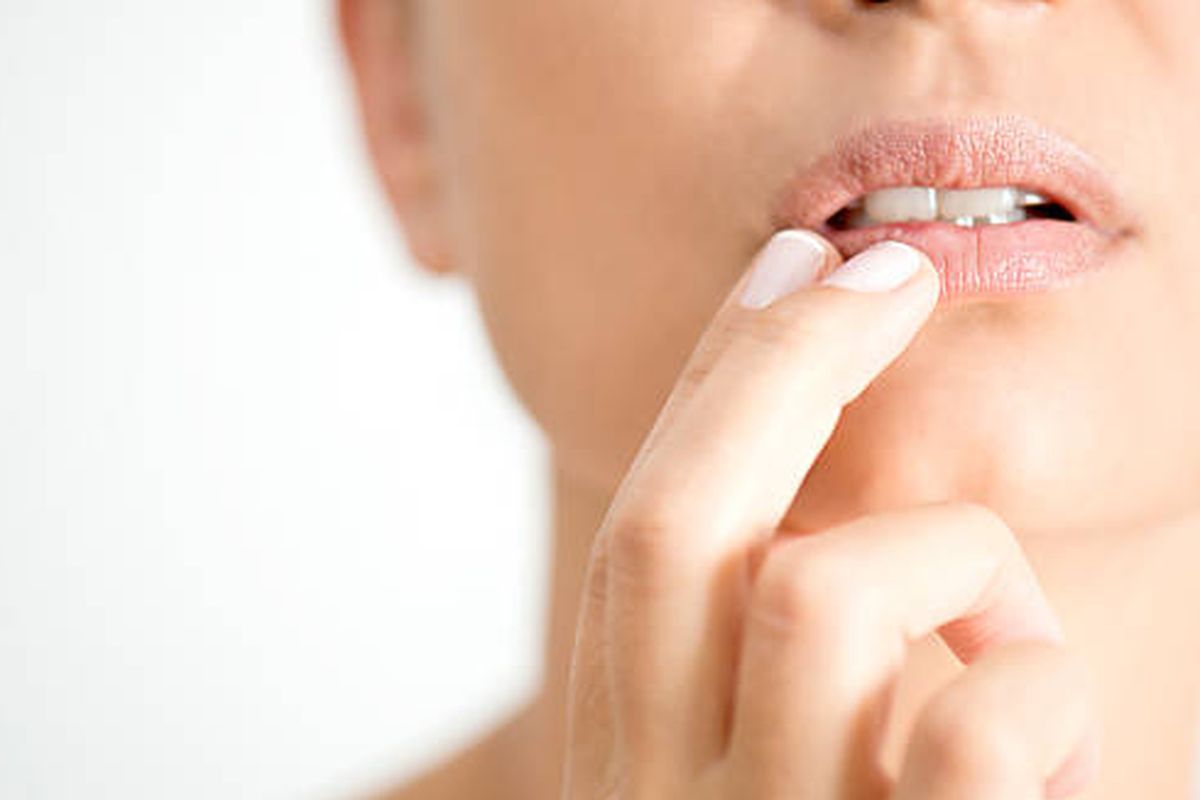 Cold Sores vs. Canker Sores: Differences, Causes, and Treatments - News Directory 3